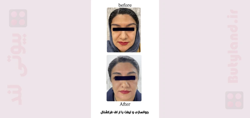کلینیک زیبایی دکتر سعیده طباطبایی (یزد)