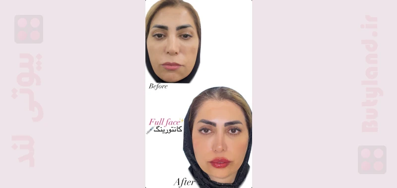 کلینیک زیبایی دکتر سعیده طباطبایی (یزد)