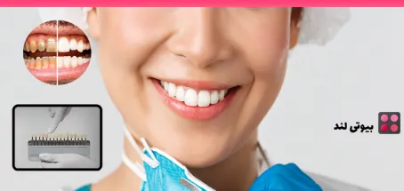 همه چیز درباره لمینت دندان: از انتخاب تا اجرا