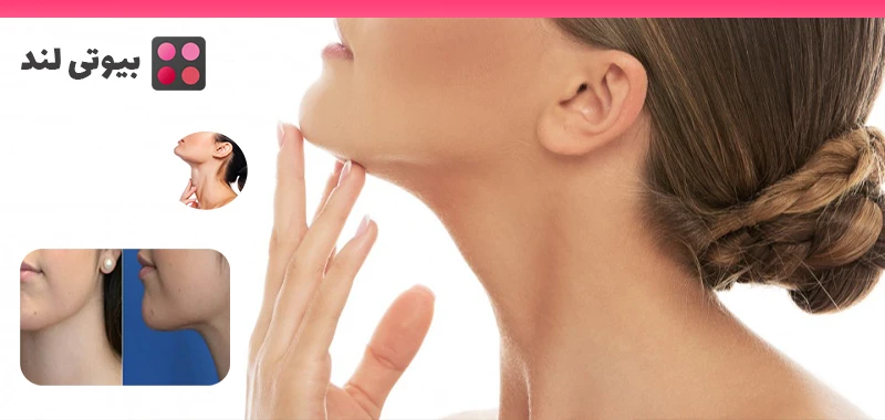 همه چیز درباره لیفت گردن: روش‌ ها و مزایای آن
