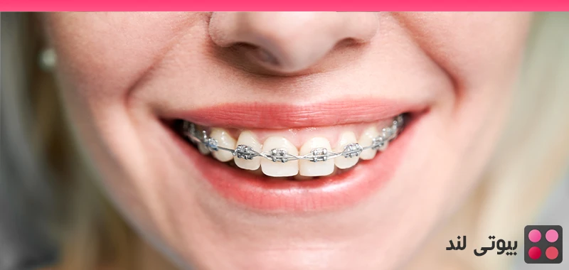 ارتودنسی: بررسی کامل از مزایا تا مشکلات