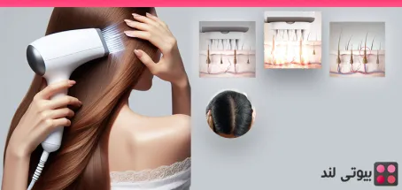 لیزر فوتونا: روشی جدید برای تقویت موی سر