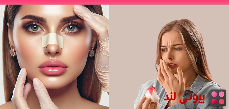خونریزی بینی بعد از جراحی بینی: روش های جلوگیری