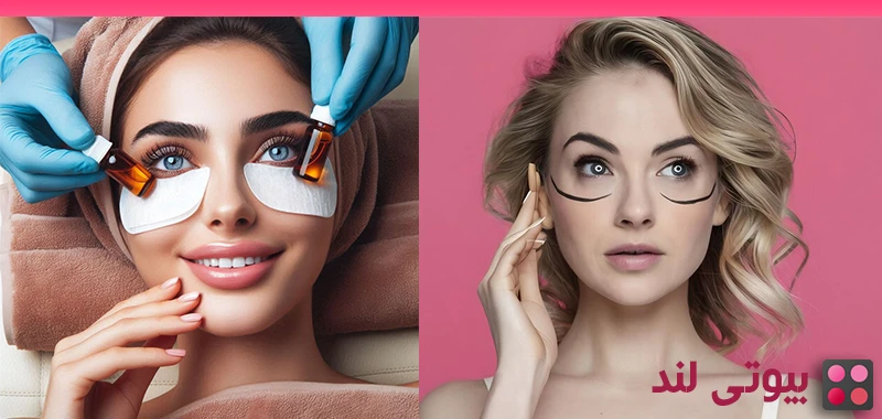 چگونه از شر پف زیر چشم خلاص شویم