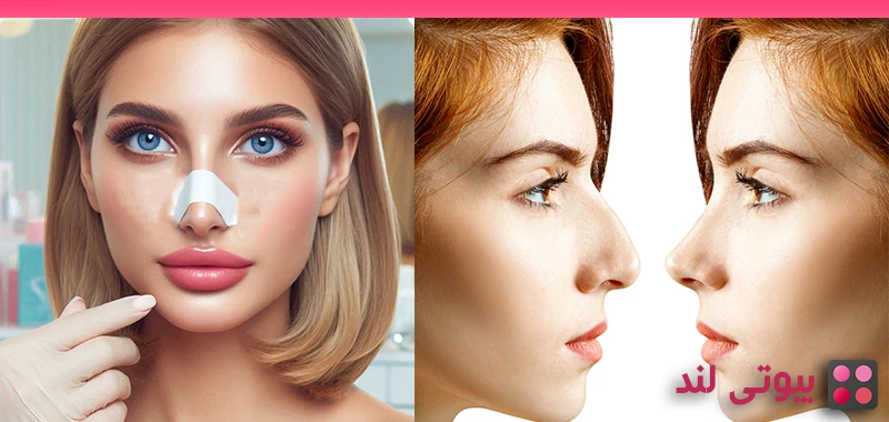 بهترین سن برای انجام جراحی بینی (راینوپلاستی) چه سنی است؟