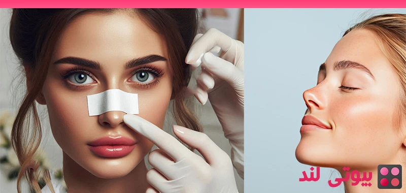 6 سوال پرطرفدار درباره جراحی بینی