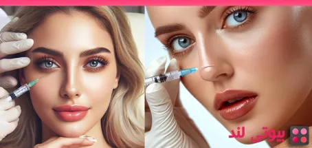 هر آنچه باید در مورد فیلرهای صورت بدانید
