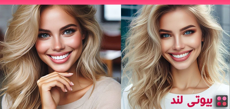 انواع روش‌ های سفید کردن دندان: کدام روش برای شما مناسب‌ تر است؟