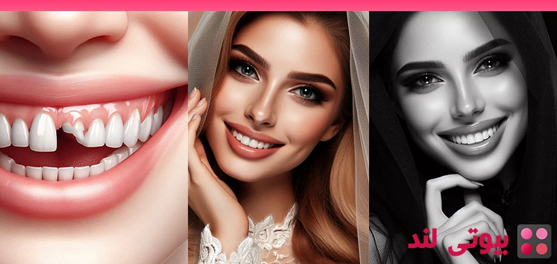 4 علت رایج افتادن دندان ها در بزرگسالی