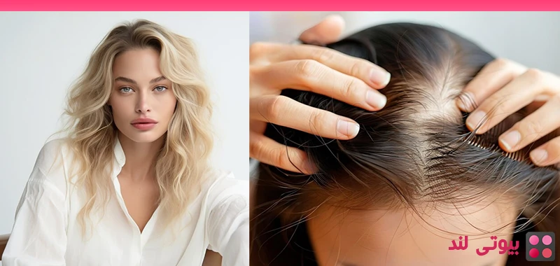 دلایل نازک شدن مو ها چیست؟