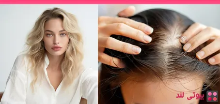 دلایل نازک شدن مو ها چیست؟