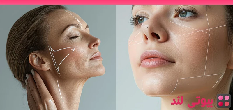 آیا می توان لیپوساکشن را روی صورت انجام داد؟