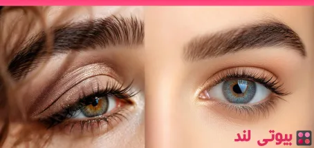 مقایسه بلفاروپلاستی سنتی و روش‌ های غیر جراحی
