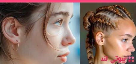 به حداقل رساندن جای زخم بعد از جراحی اتوپلاستی