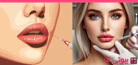 مراقبت های بعد از تزریق فیلر لب – نکات مهم بعد از تزریق