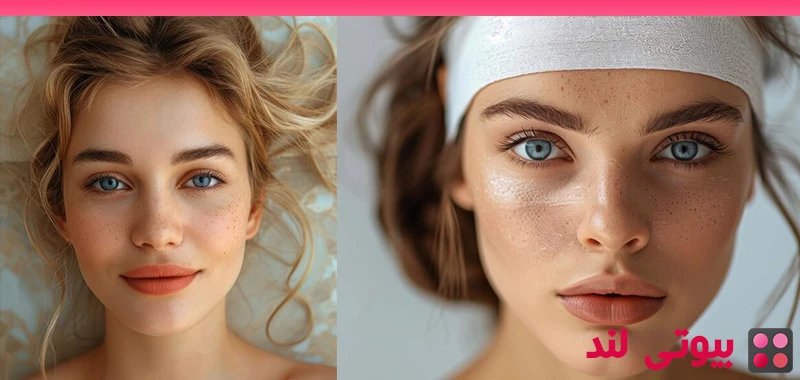 چگونه از شر پوست چرب خلاص شویم؟
