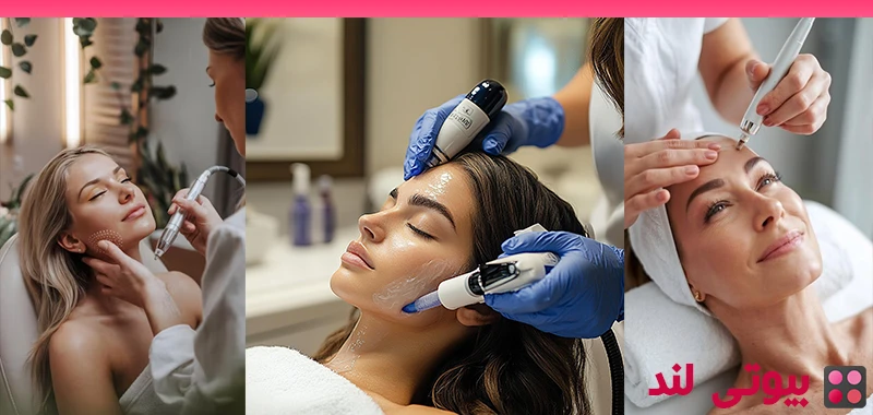 میکرودرم ابریژن یا میکرونیدلینگ؟ کدام انتخاب بهتری است؟