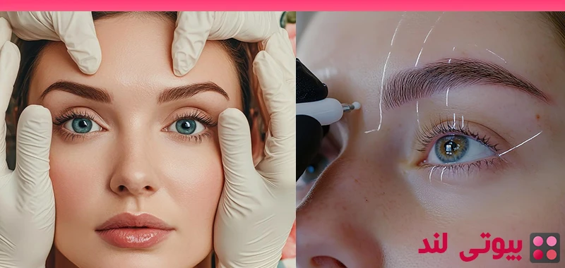 چه افرادی کاندیدای مناسب برای کاشت ابرو هستند؟