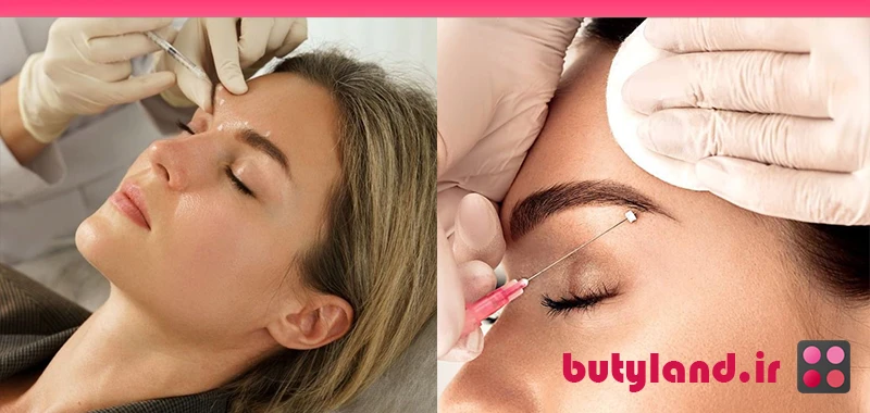 مزوتراپی ابرو چیست؟ هزینه، تعداد جلسات، عوارض و نتایج واقعی